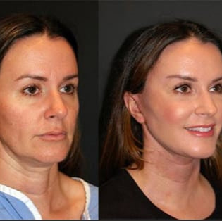 Skinova™ Beauty Mask