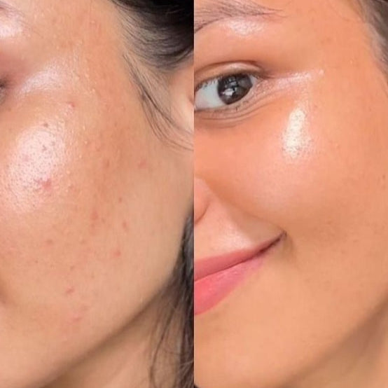Skinova™ Beauty Mask